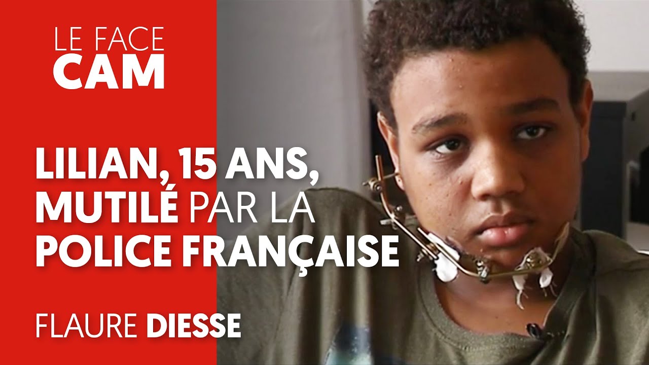 LILIAN, 15 ANS, MUTILÉ PAR LA POLICE FRANÇAISE