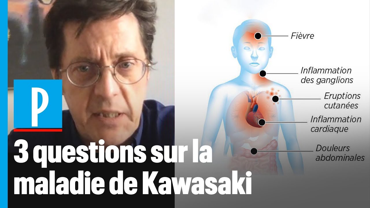 Syndrome de Kawasaki et Covid-19: “Une forte fièvre et des problèmes digestifs au premier plan”
