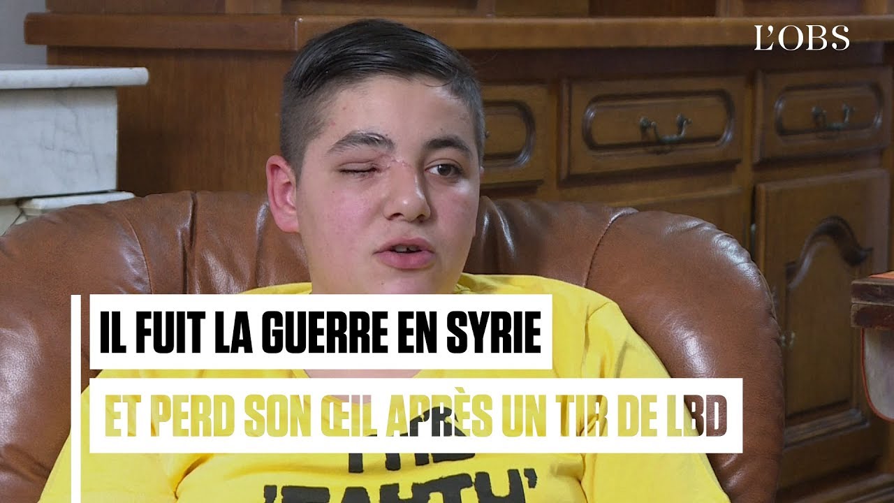 Un gosse de 15 ans échappe à la guerre en Syrie et perd son œil en France après un tir de LBD