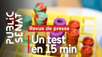 un-test-serologique-du-covid-19