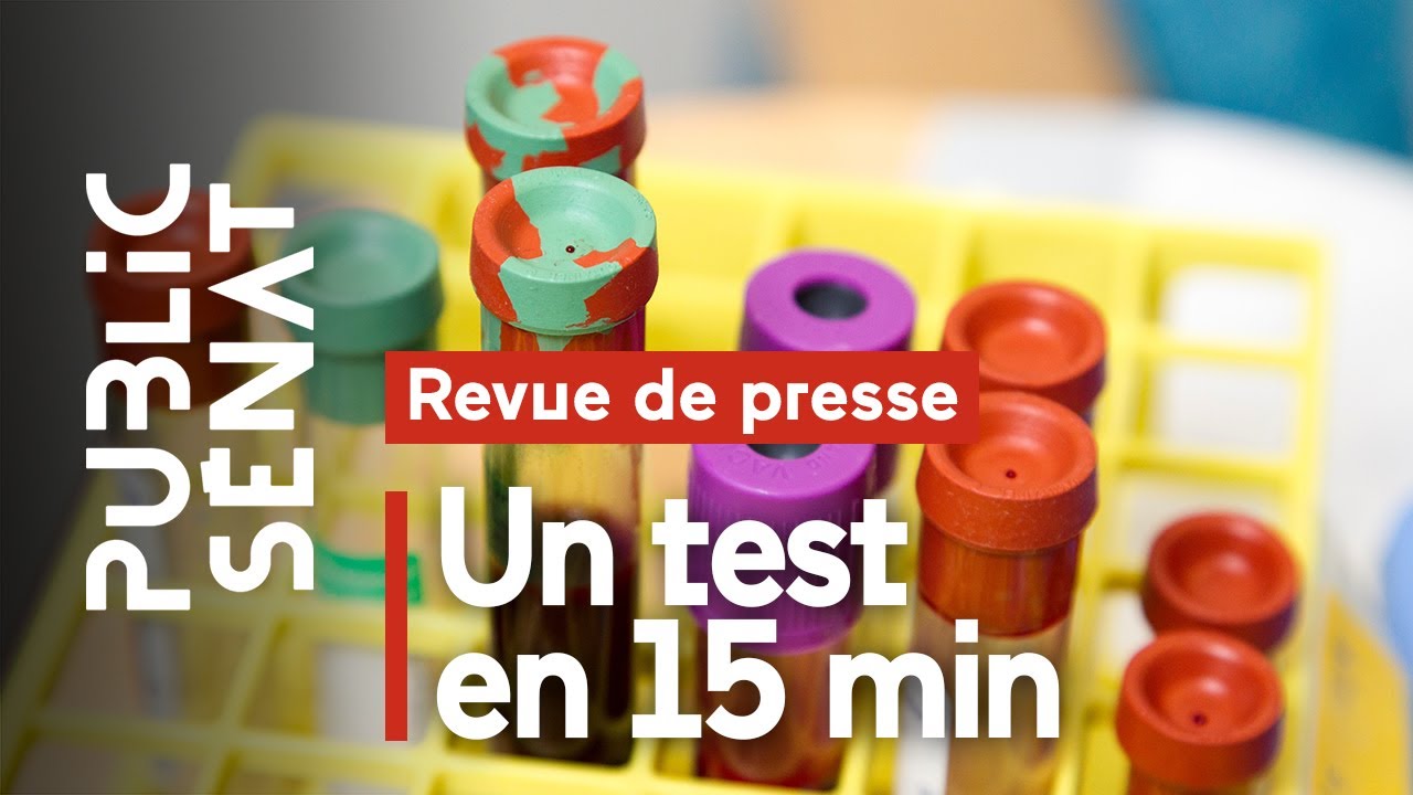 Un test sérologique du Covid-19 en 15 minutes commercialisé par une start-up bretonne