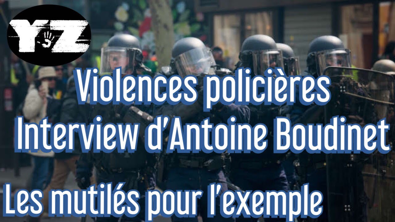 Violences policières.Interview d’Antoine Boudinet dont la main a été arrachée par une grenade GLI-F4